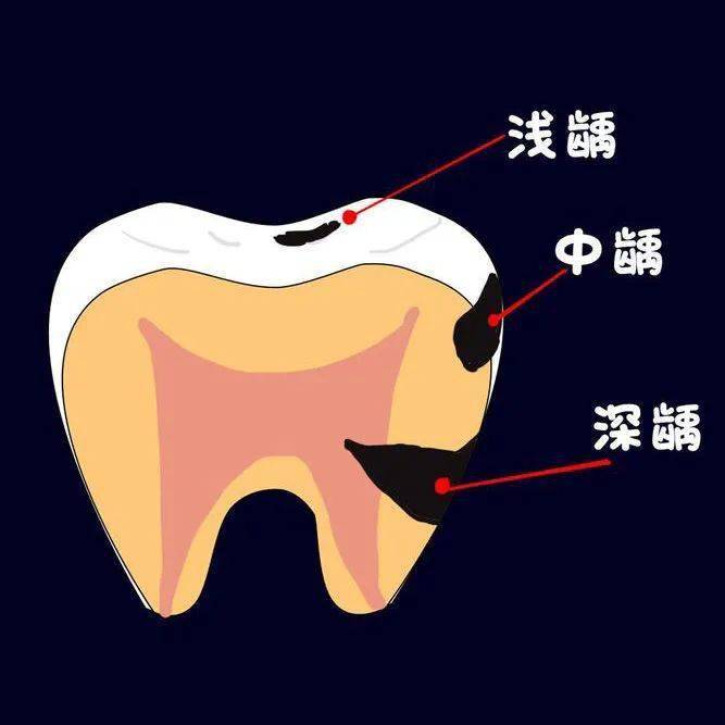 华为商城的手机小毛病
:医生来科普│不应被忽视的“小毛病”-第1张图片-太平洋在线下载